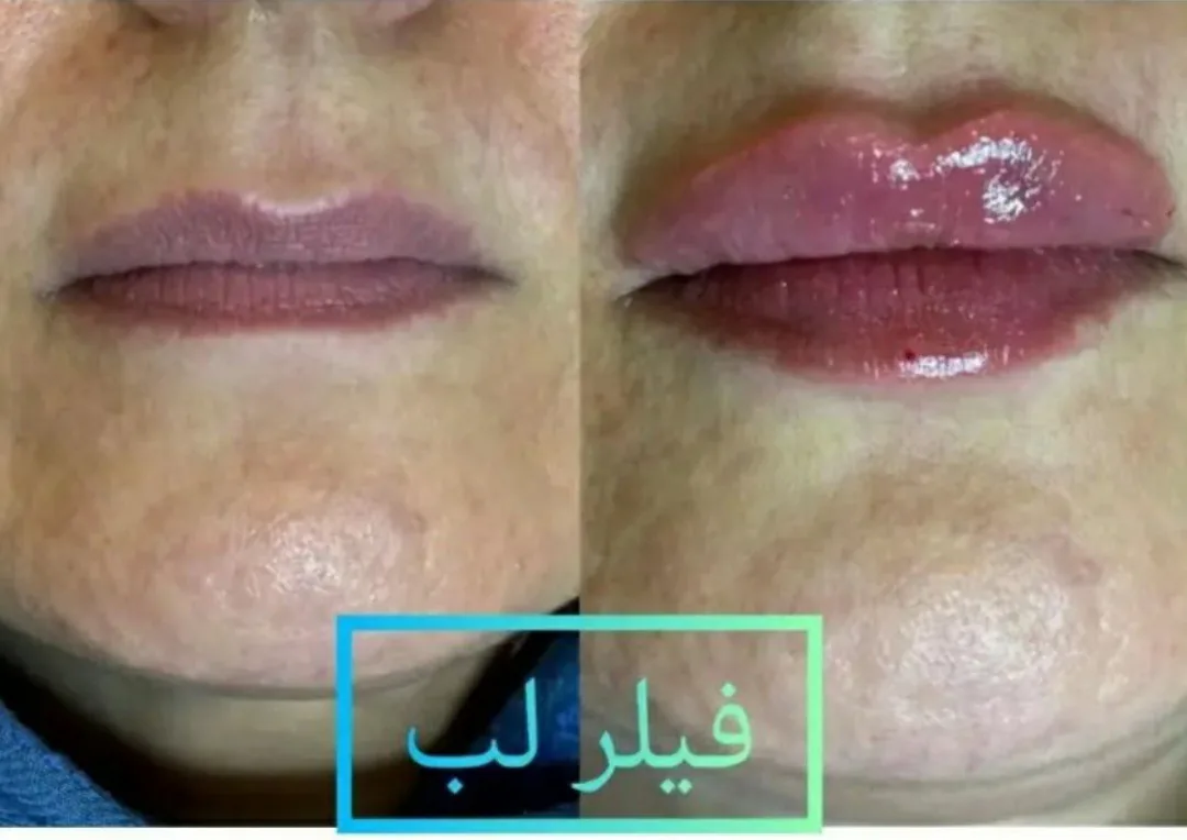 مرکز لیزرو کلینیک زیبایی طراوت - تصویر 3