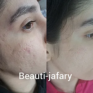 فیشال وپاکسازی و کربوکسی صبا
