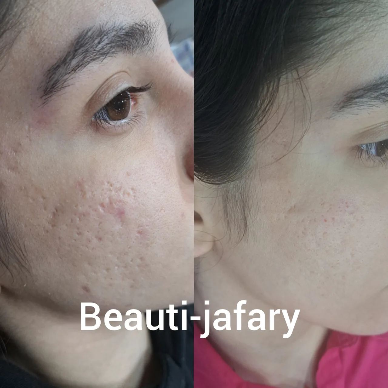 فیشال وپاکسازی و کربوکسی صبا