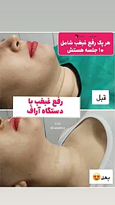 کلینیک تخصصی لاغری موضعی ولافیت