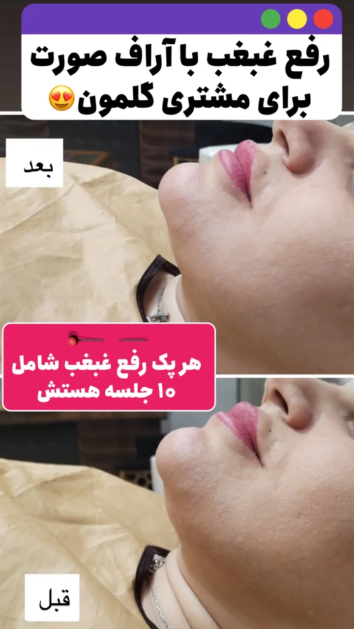 کلینیک تخصصی لاغری موضعی ولافیت - تصویر 2