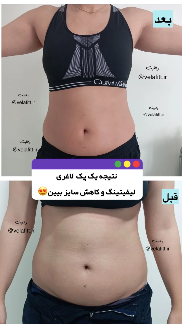 کلینیک تخصصی لاغری موضعی ولافیت - تصویر 3