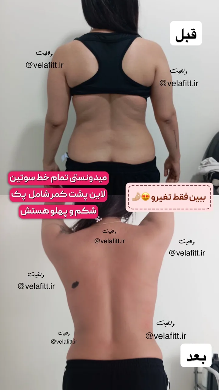 کلینیک تخصصی لاغری موضعی ولافیت - تصویر 4