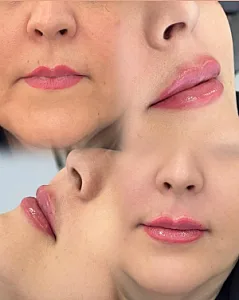 کلینیک زیبایی لیزر و لاغری سیب سبز