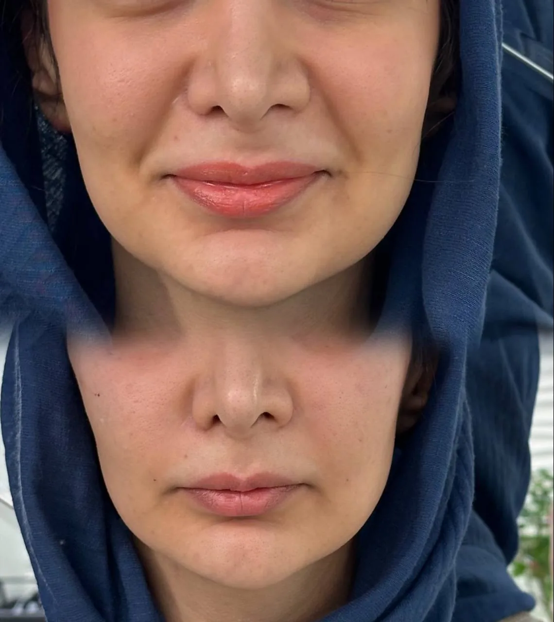 کلینیک زیبایی لیزر و لاغری سیب سبز - تصویر 2