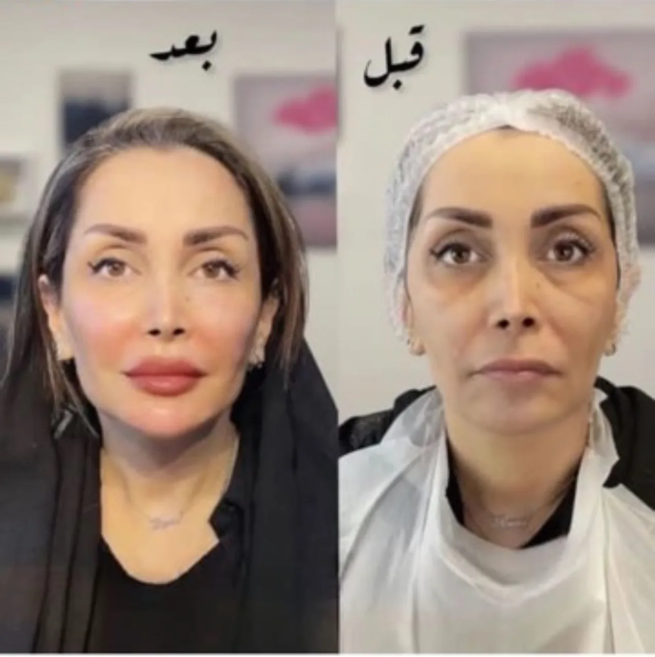 کلینیک زیبایی و لاغری نفیس - تصویر 2