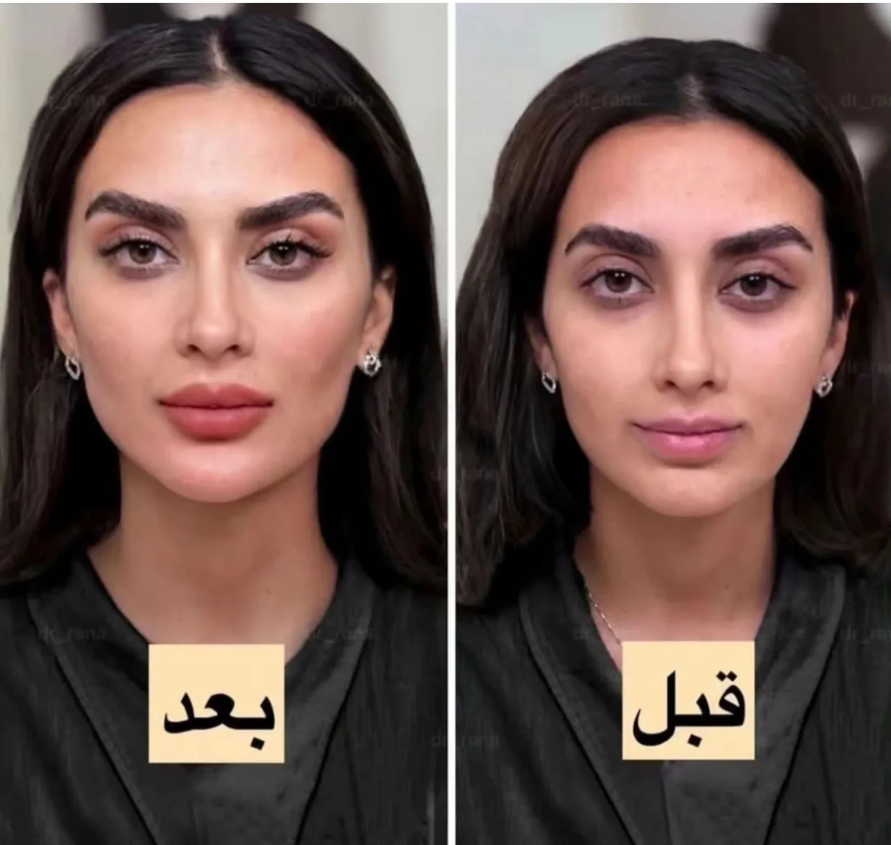 کلینیک زیبایی و لاغری نفیس - تصویر 3