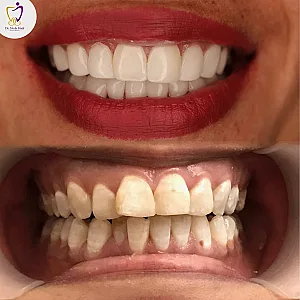 کلنیک دندانپزشکی ندا هادی شعبه اندرزگو