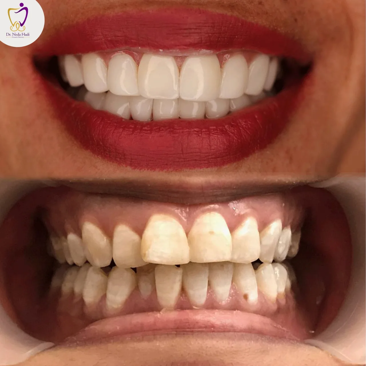 کلنیک دندانپزشکی ندا هادی شعبه اندرزگو