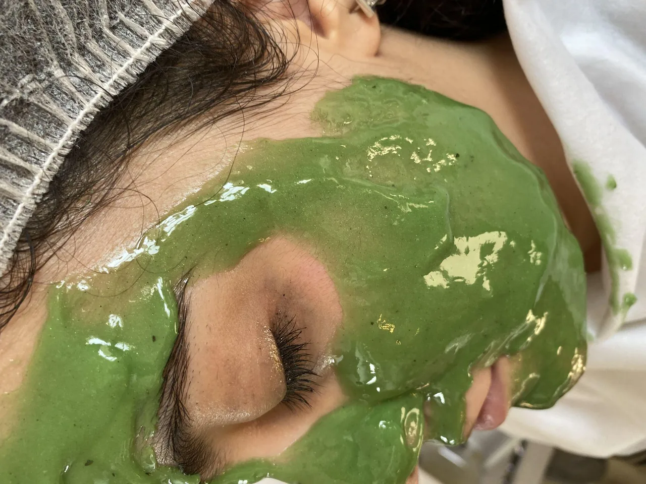 فیشال و پاکسازی تخصصی پوست