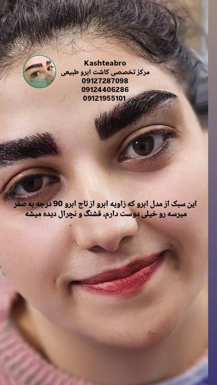 کاشت ابرو طبیعی - تصویر 2