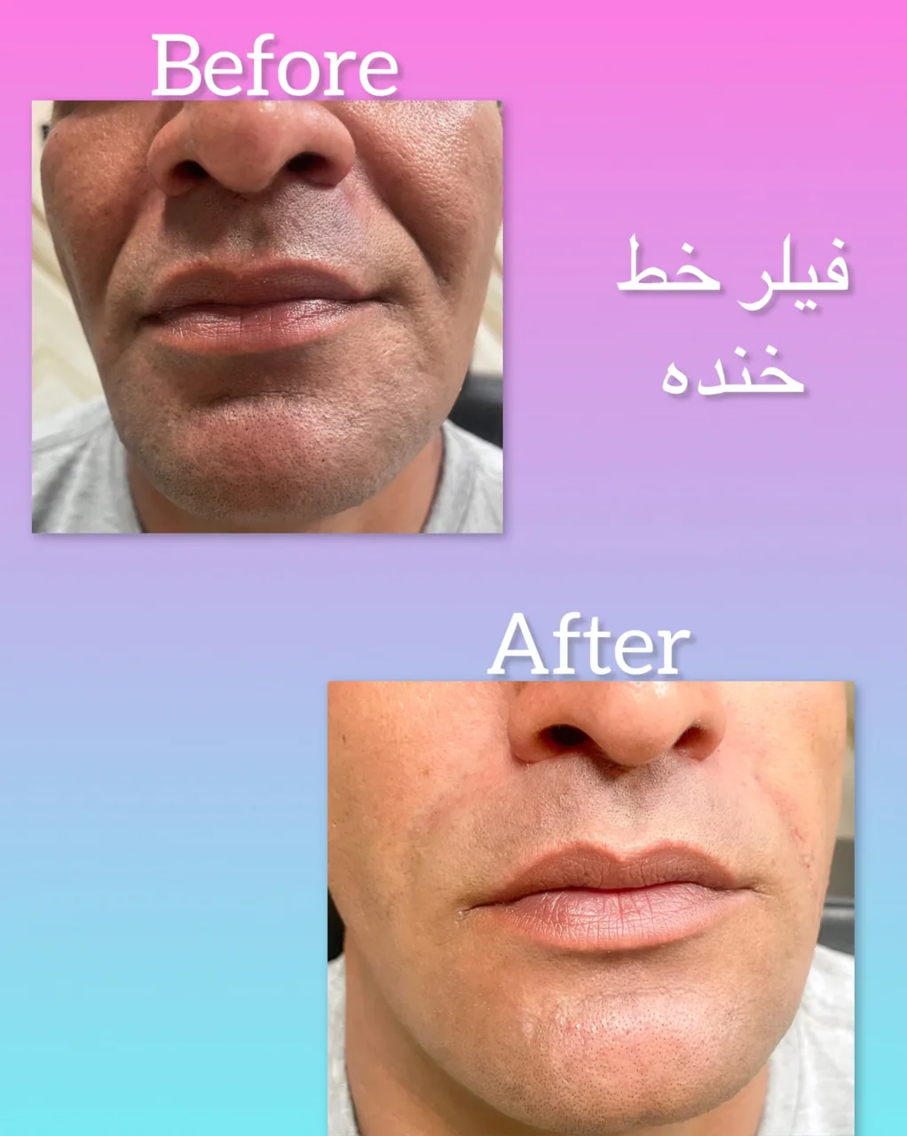 کلینیک زیبایی و کلینیک لیزر  ال آی - تصویر 2