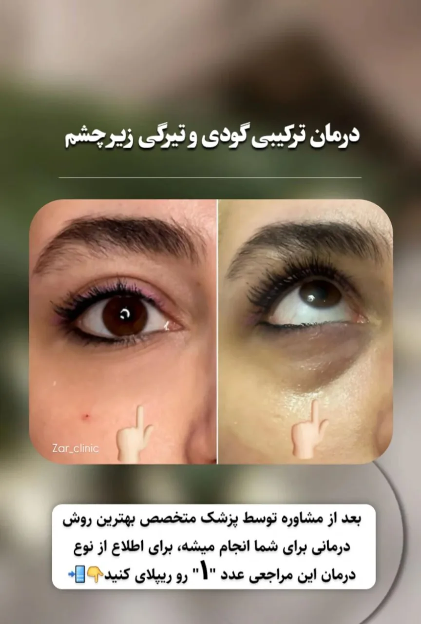 کلینیک تخصصی زیبایی و لیزر موی ابریشم - تصویر 3
