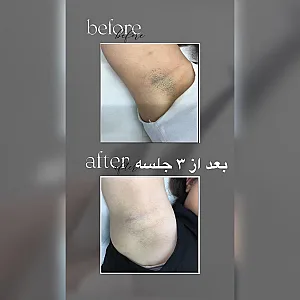 مرکز لیزر موهای زائد ژوان