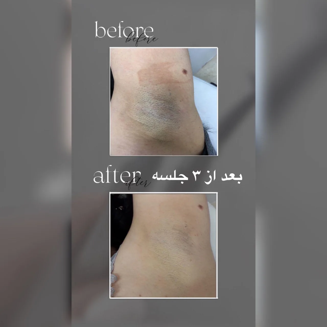 مرکز لیزر موهای زائد ژوان - تصویر 2