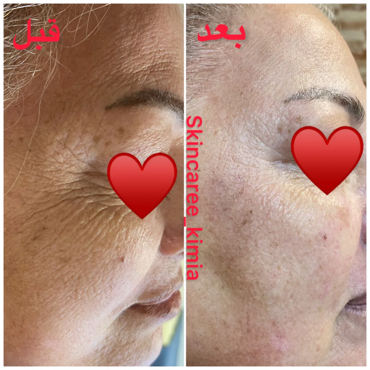 پاکسازی پوست کیمیا صدری - تصویر 2