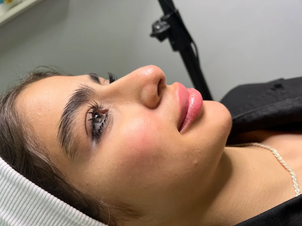 کلینیک لیزر ،ژل ،بوتاکس و لاغری ویتالایف - تصویر 2