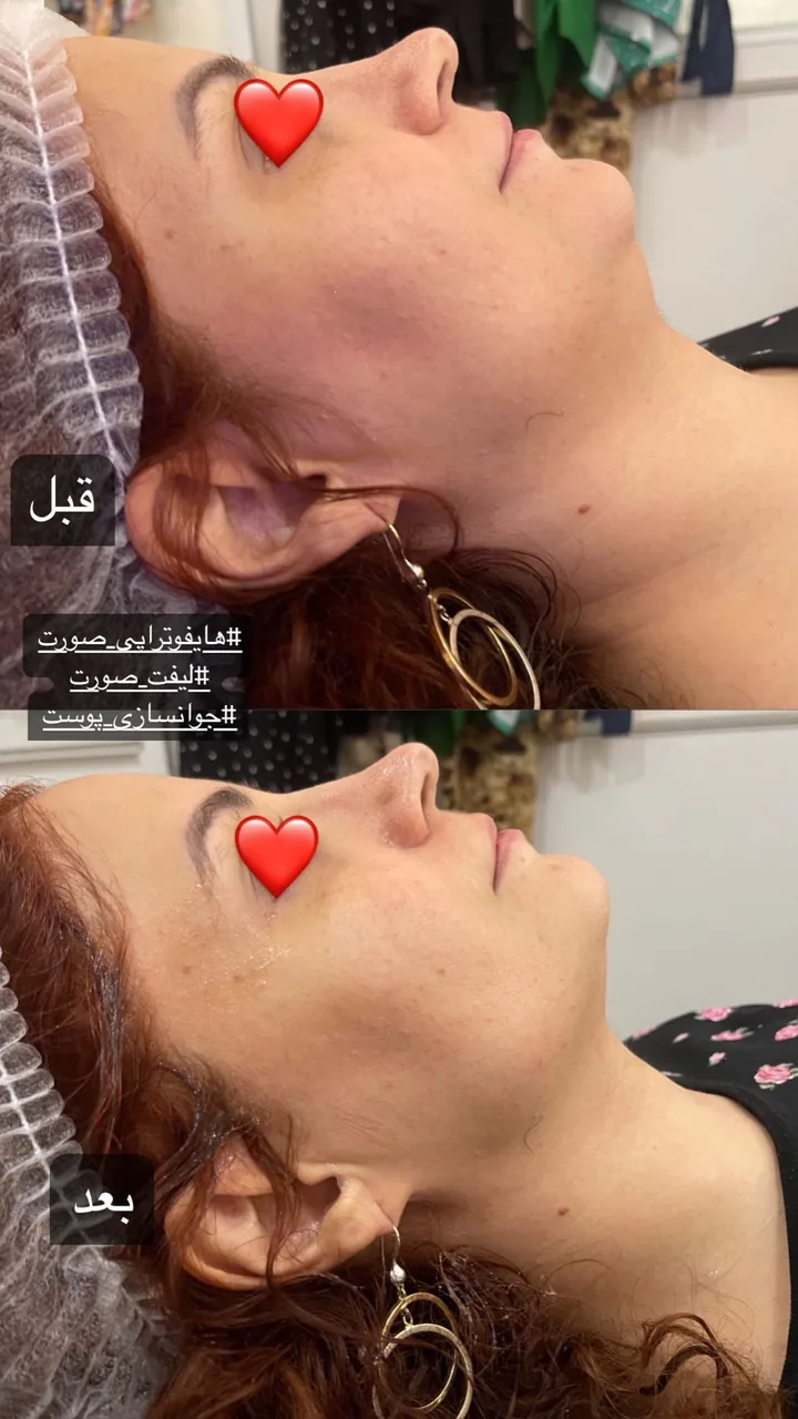 مرکز لیزر و کلینیک زیبایی گلها - تصویر 2