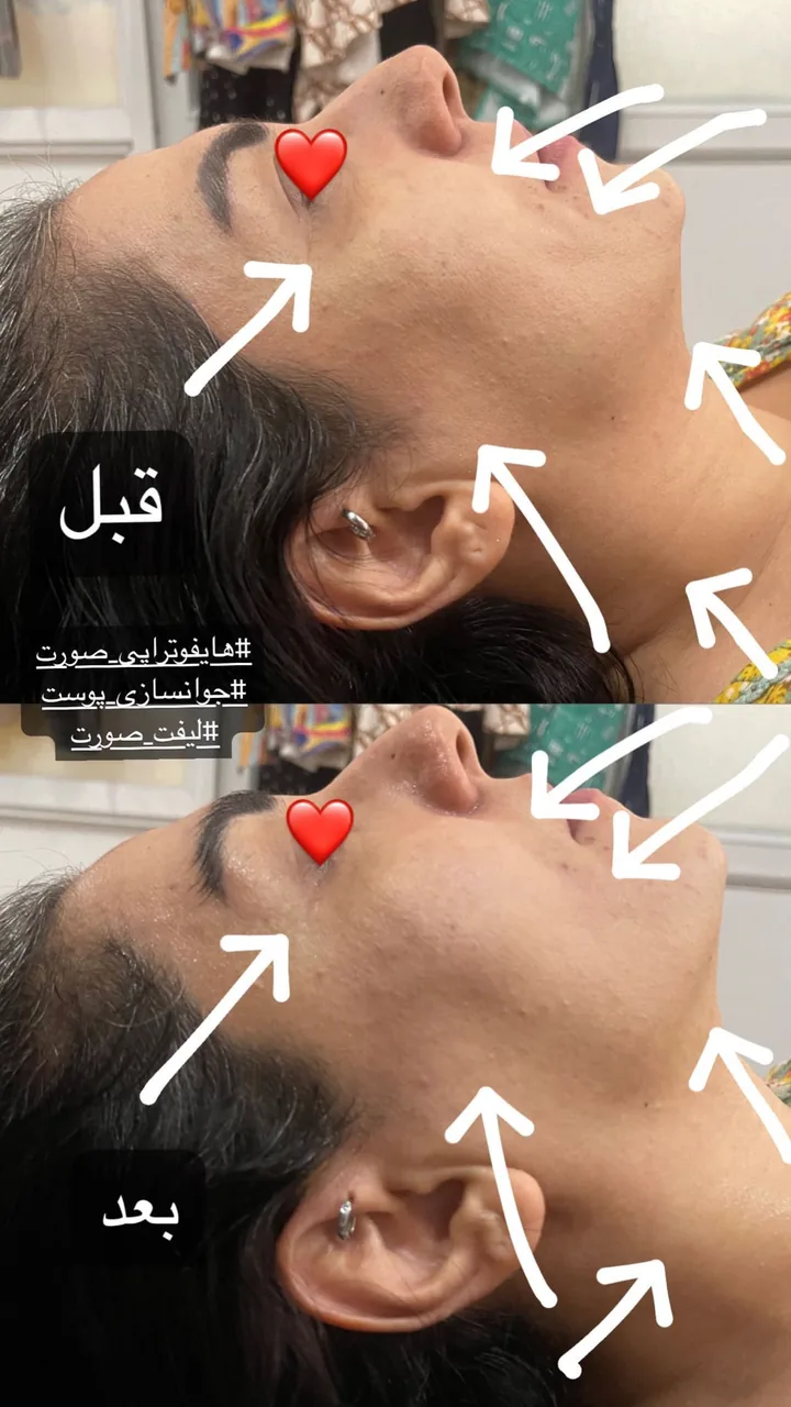 مرکز لیزر و کلینیک زیبایی گلها - تصویر 3
