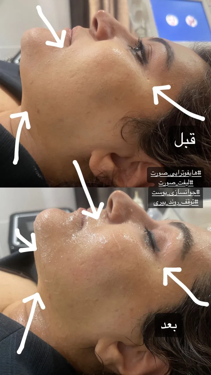 مرکز لیزر و کلینیک زیبایی گلها - تصویر 4