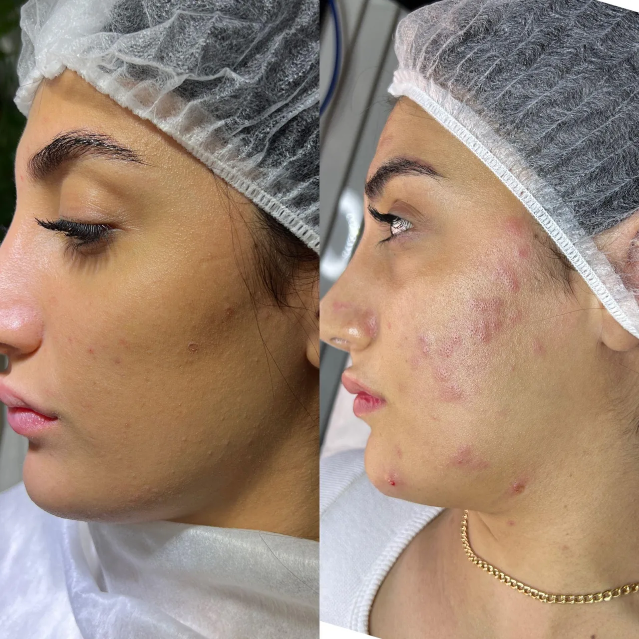 کلینیک تخصصی پوست  Skinmicro.sanaz - تصویر 2