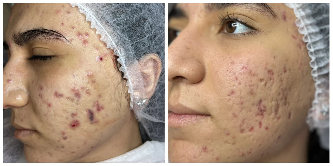کلینیک تخصصی پوست  Skinmicro.sanaz - تصویر 3