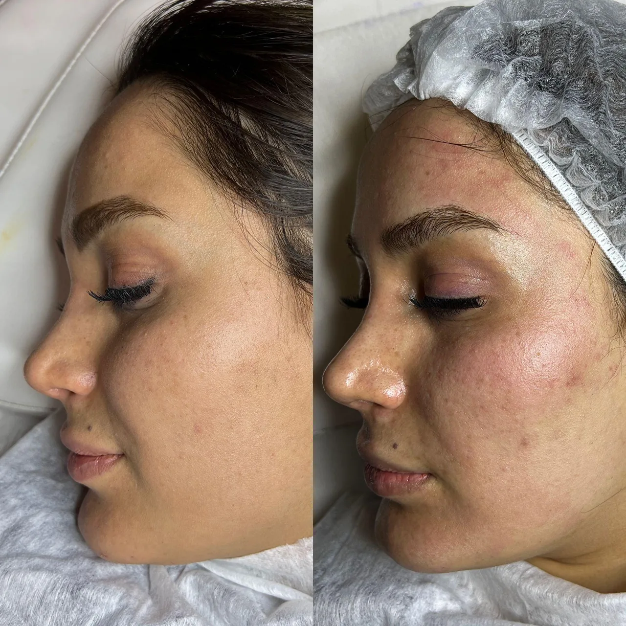 کلینیک تخصصی پوست  Skinmicro.sanaz - تصویر 4