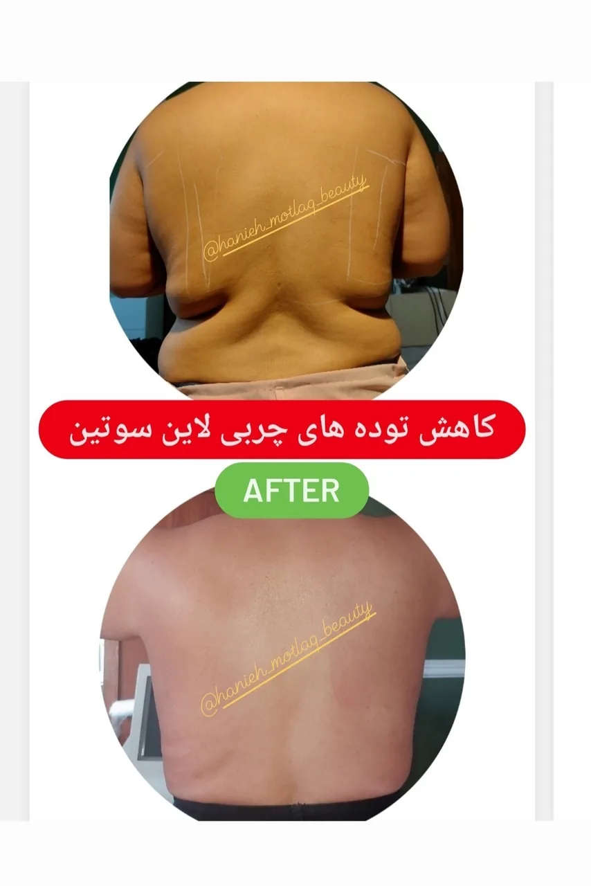 کلینیک لیزر و لاغری مطلق - تصویر 2