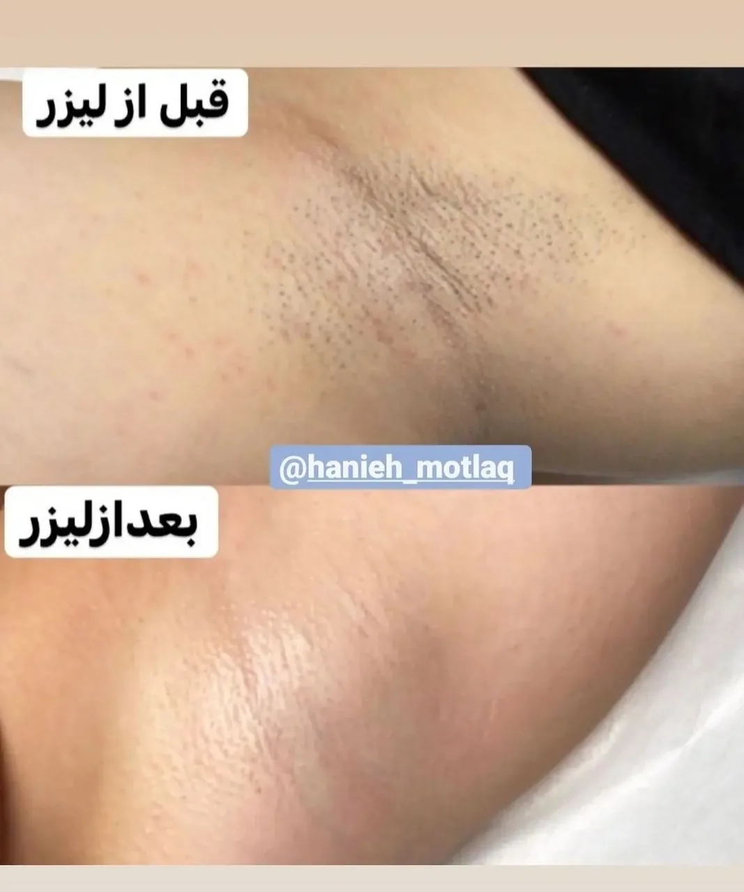 کلینیک لیزر و لاغری مطلق - تصویر 3