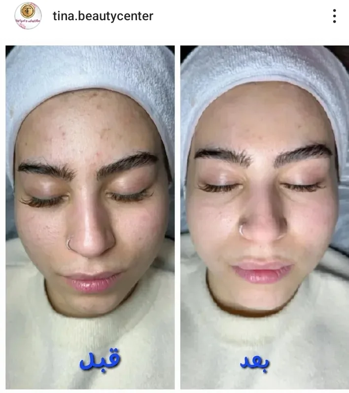مرکز پوست و مو زیبایی تینا - تصویر 2
