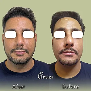 مرکز سلامت و زیبایی آمیس