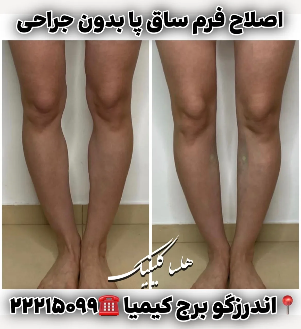 *کلینیک زیبایی هلسا* - تصویر 2
