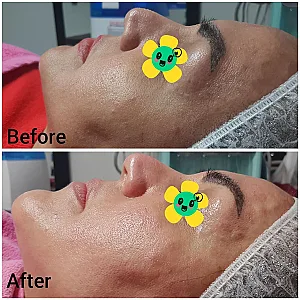 فیشیال روناک