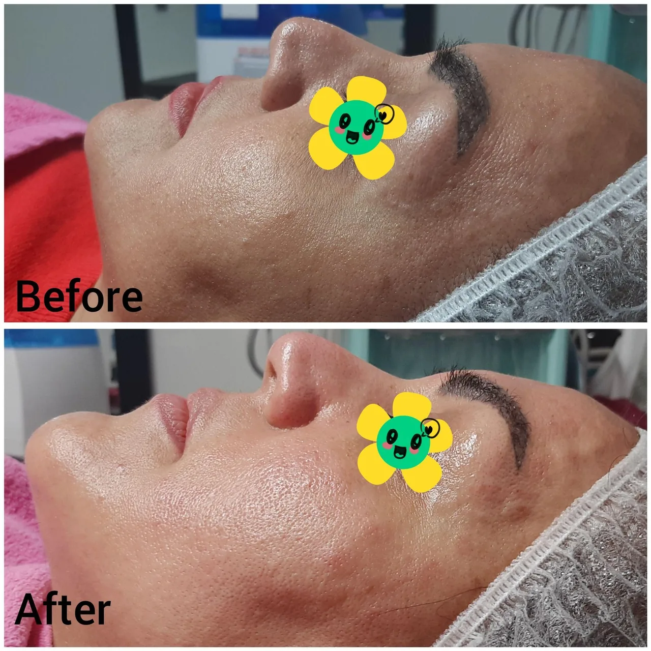 فیشیال روناک