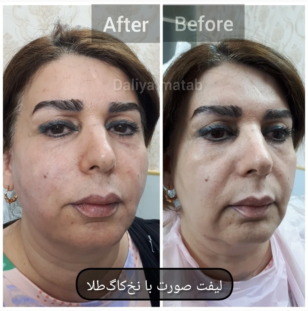 کلینیک پوست و مووزیبایی دالیا - تصویر 2