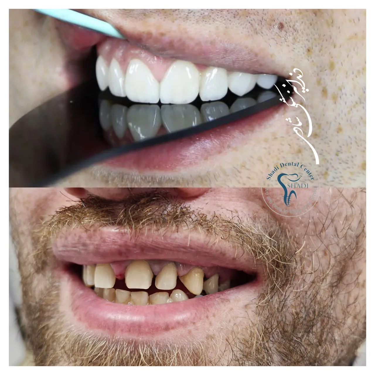مرکز دندانپزشکی و ایمپلنت شادی - تصویر 2