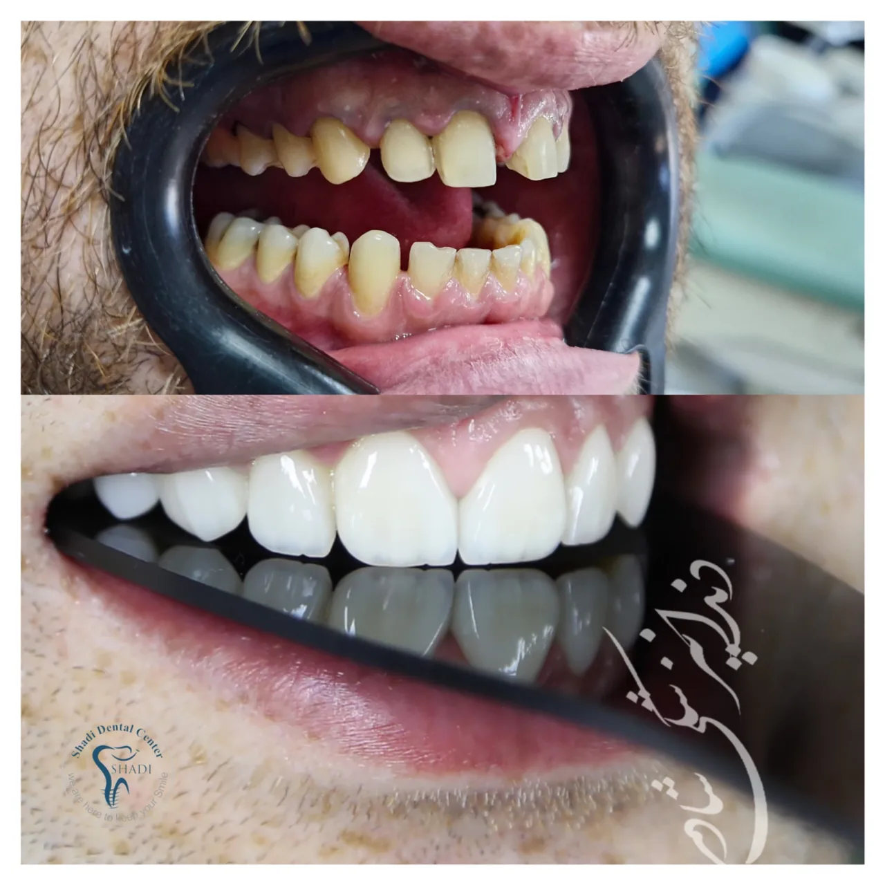 مرکز دندانپزشکی و ایمپلنت شادی - تصویر 3
