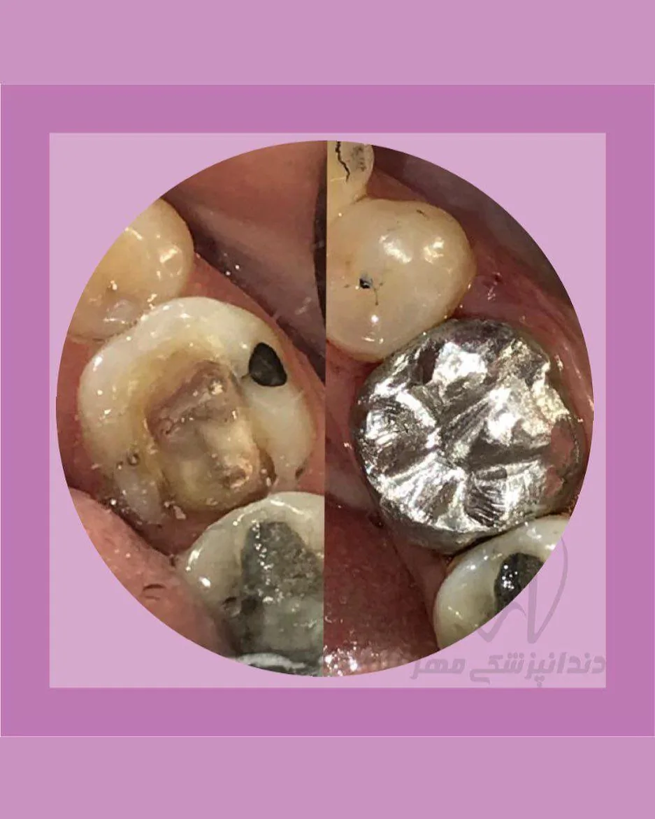 کلینیک دندانپزشکی مهرنژاد - تصویر 3