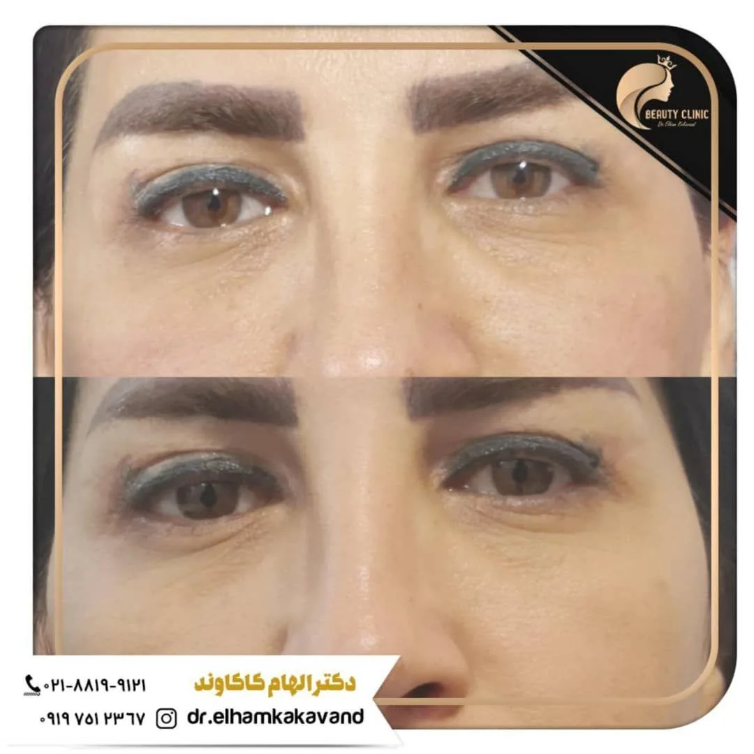 کلینیک پوست و زیبایی نگار                                           دکترالهام کاکاوند - تصویر 2
