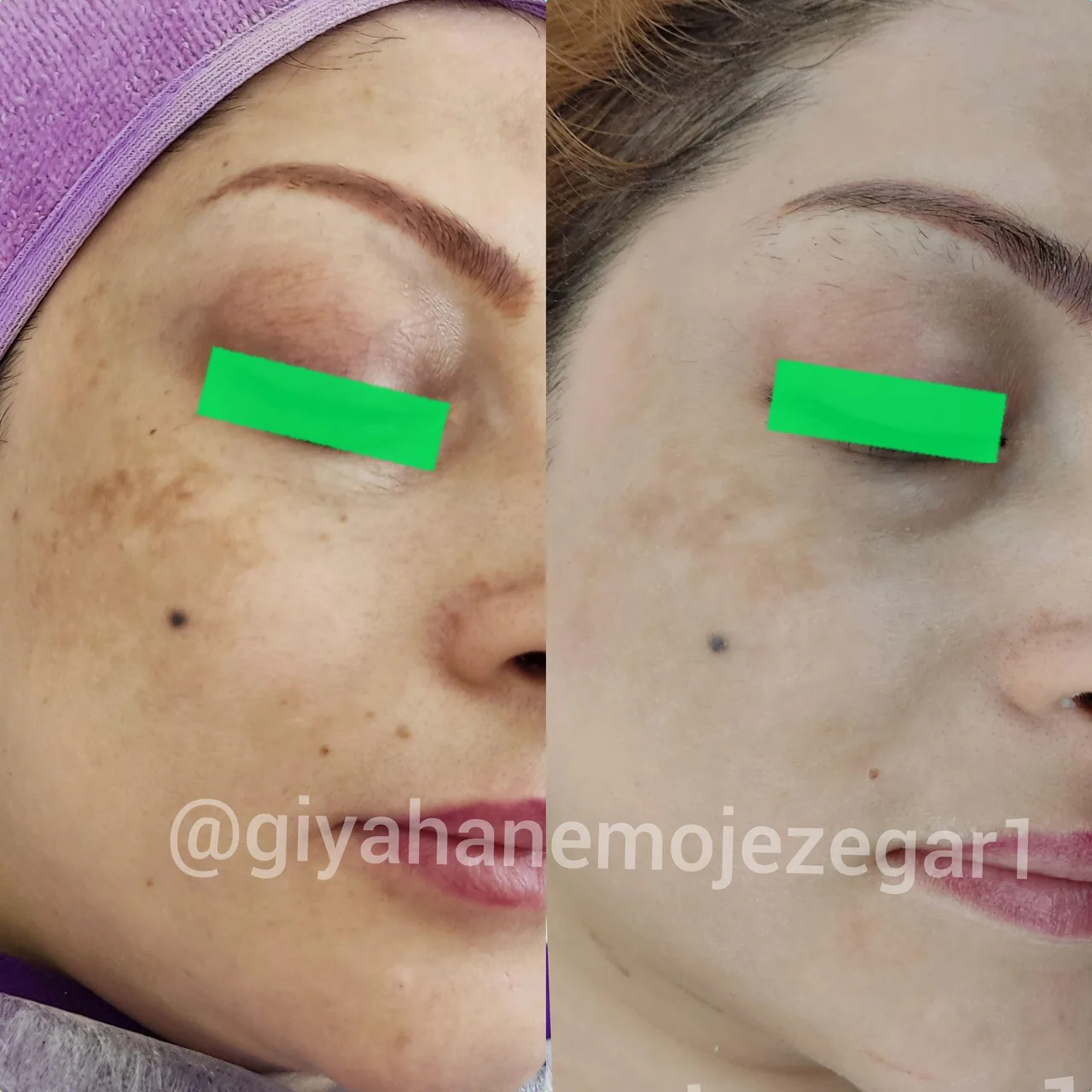 کلینیک پوست ومو لاغری ایپک - تصویر 2