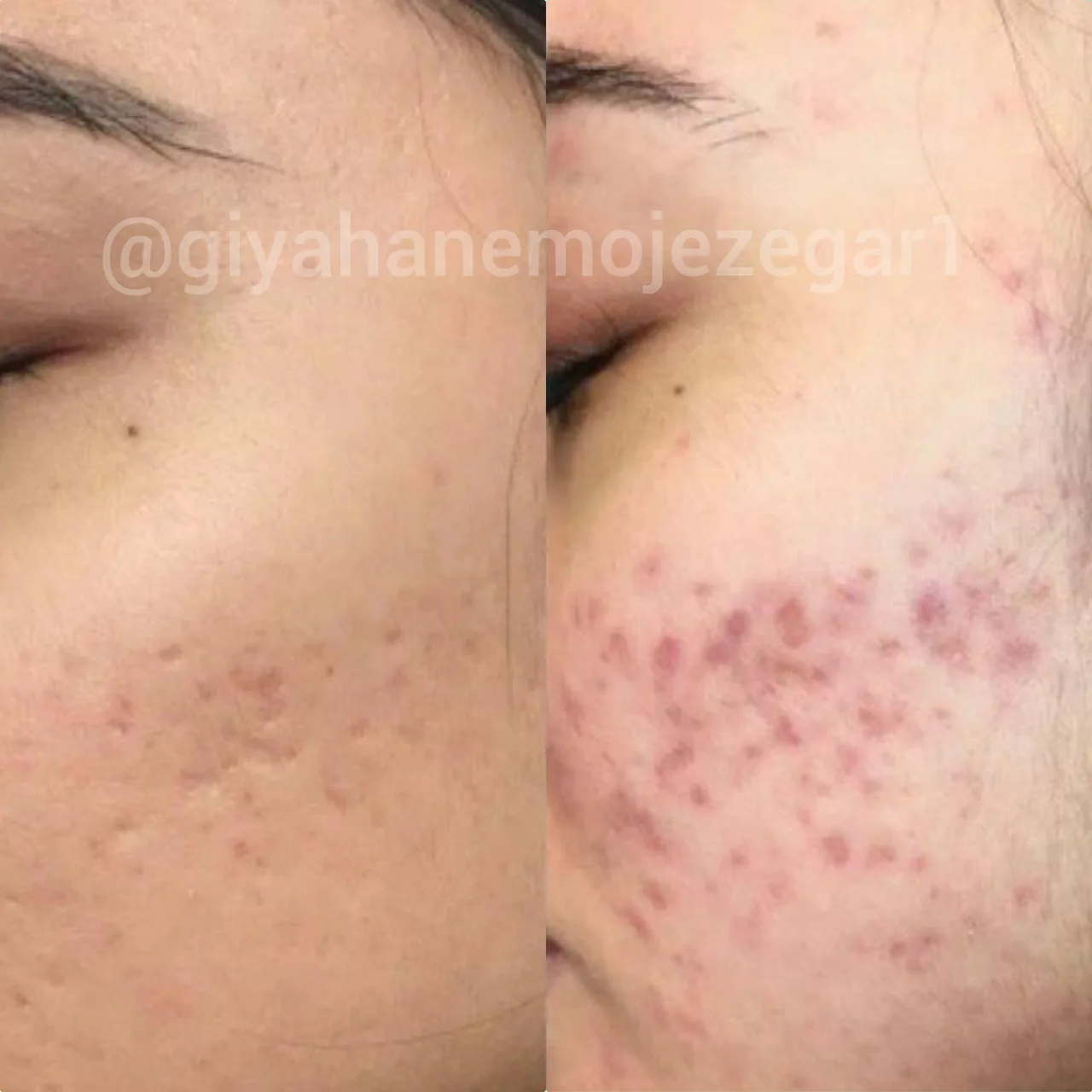 کلینیک پوست ومو لاغری ایپک - تصویر 3