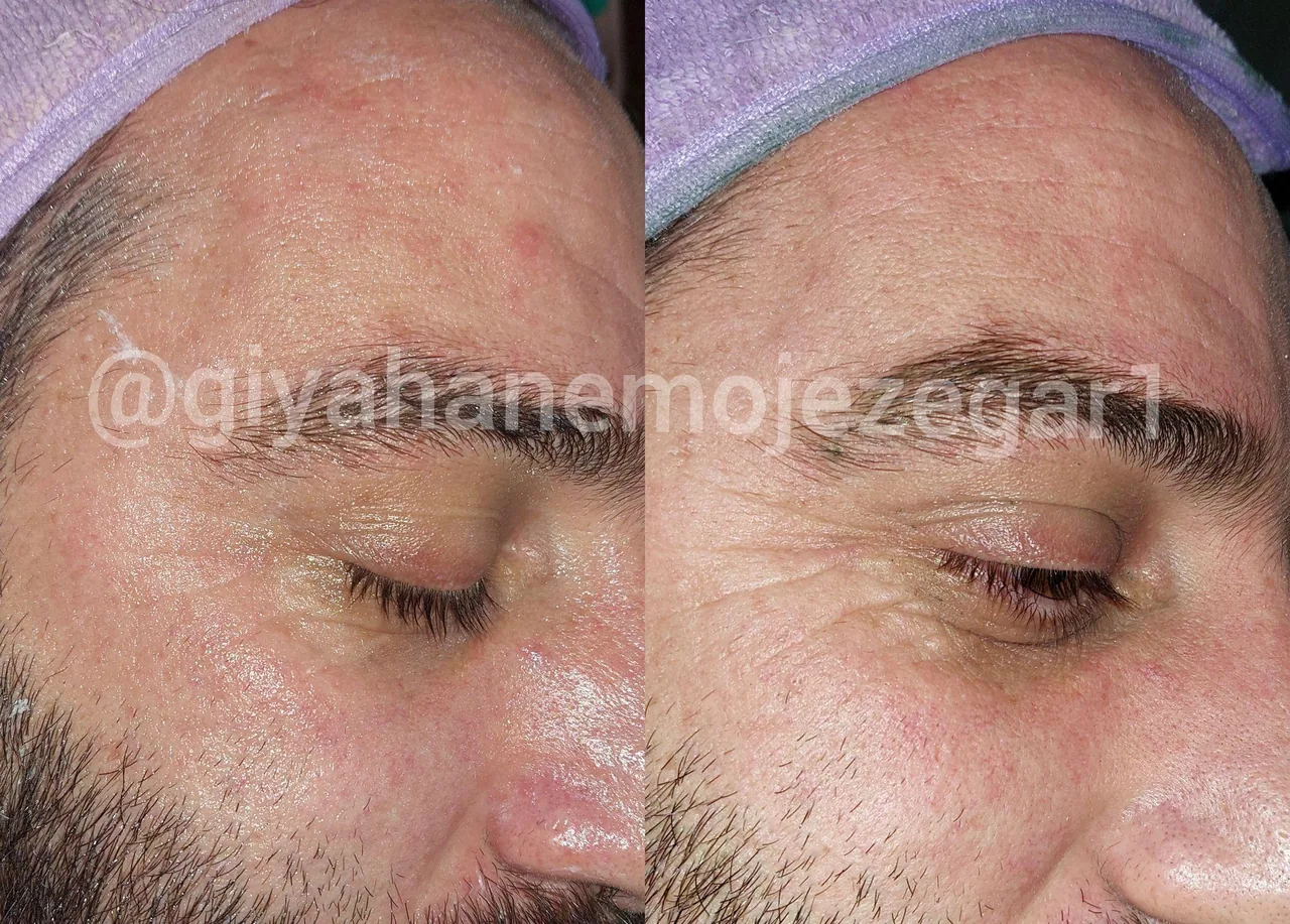 کلینیک پوست ومو لاغری ایپک - تصویر 4