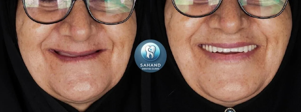 کلینیک دندانپزشکی وایمپلنت سهند(لاجوردی) - تصویر 4