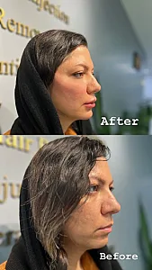 کلینیک زیبایی و لیزر لیانا