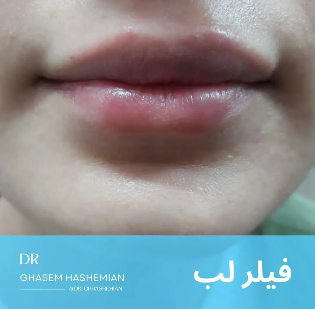 مرکز لیزر و لاغری آیسان - تصویر 2
