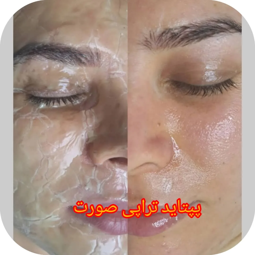 فیشیال تخصصی سهیلا - تصویر 2