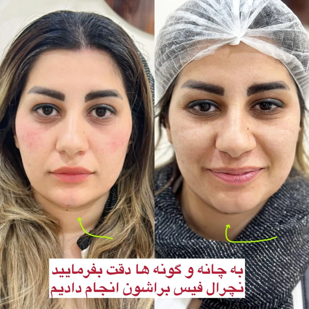 مرکز لیزر و کلینیک زیبایی محنا امین - تصویر 2