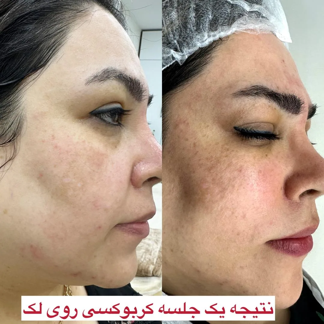 مرکز لیزر و کلینیک زیبایی محنا امین - تصویر 3