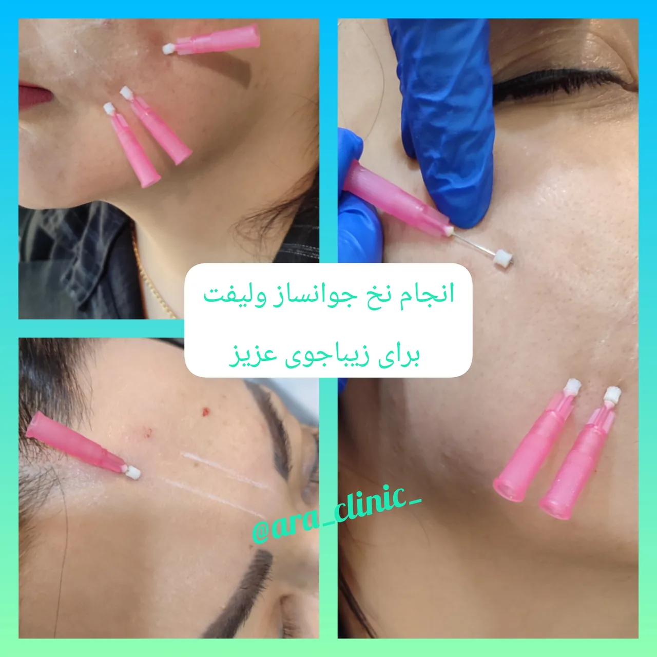 مرکز لیزر و کلینیک زیبایی آرا