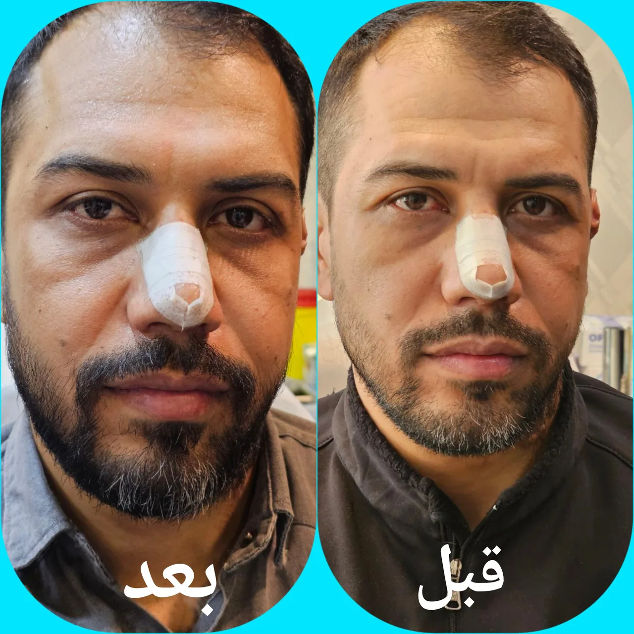 مرکز لیزر و کلینیک زیبایی آرا - تصویر 4